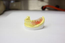 目立たない入れ歯