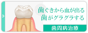 歯茎から血が出る、歯がグラグラする
